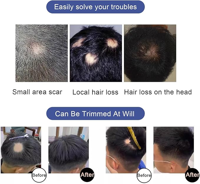 Hair Piece/Patch