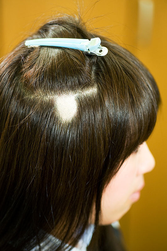 Hair Piece/Patch