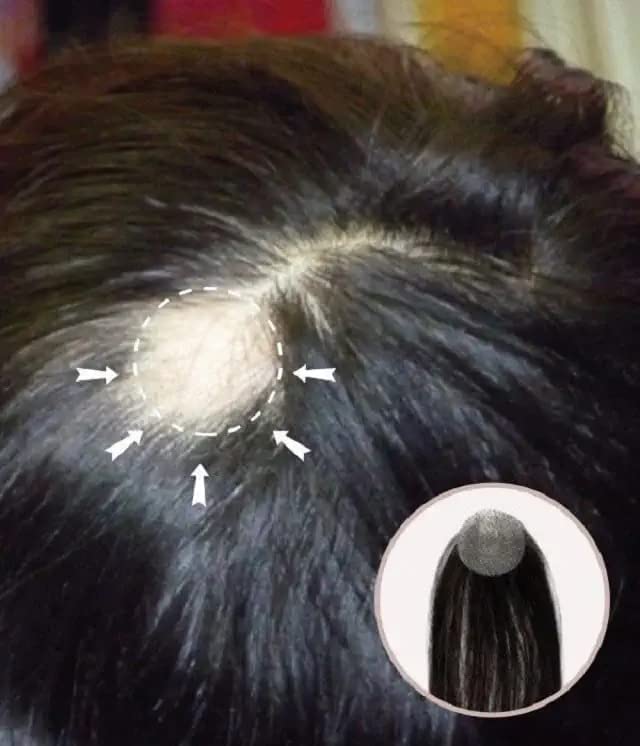 Hair Piece/Patch