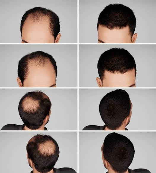 Men's Patches/Toupee Color Chic