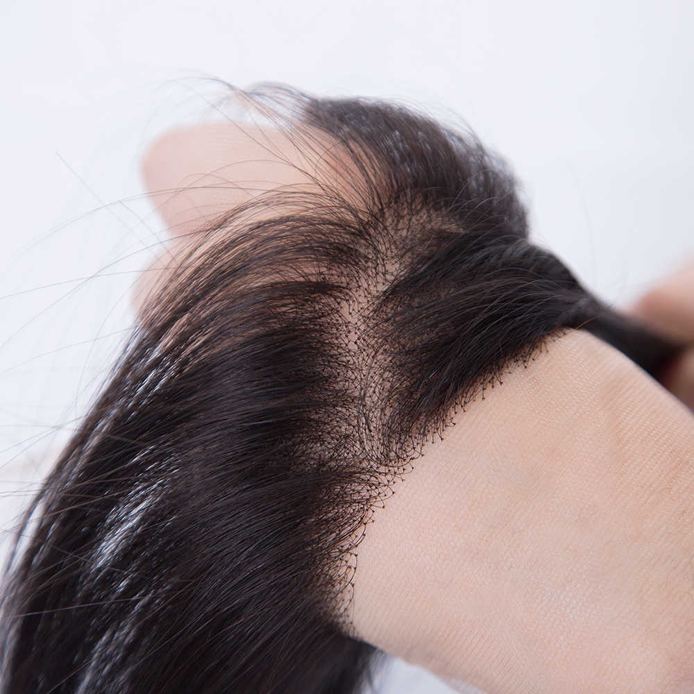 Front line Hair Patch