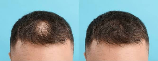 Men's Patches/Toupee Color Chic