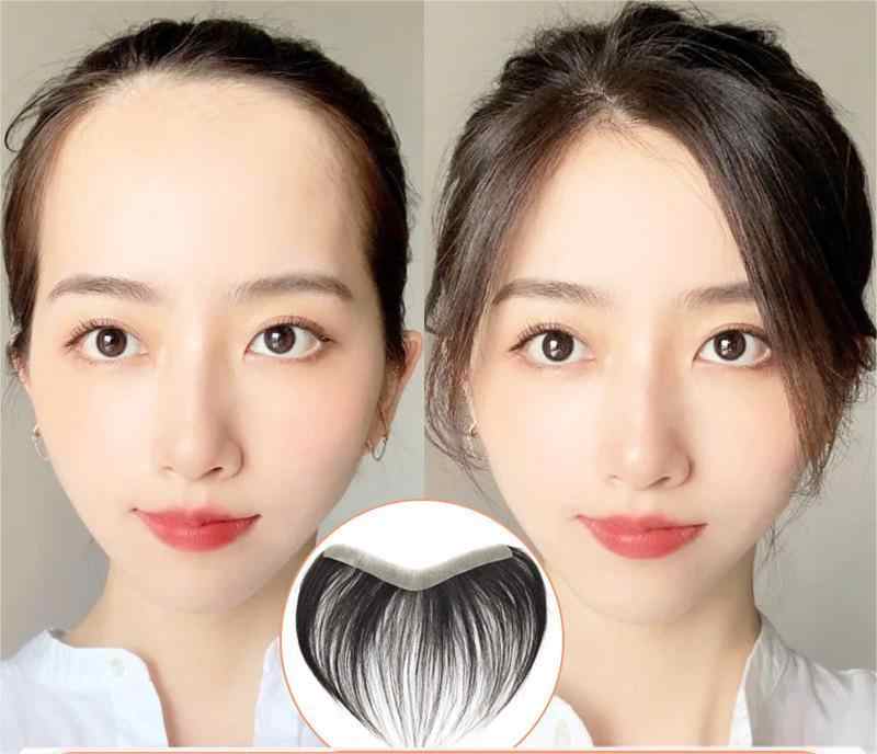 Front line Hair Patch