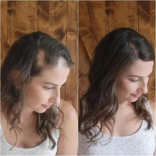 Hair Piece/Patch